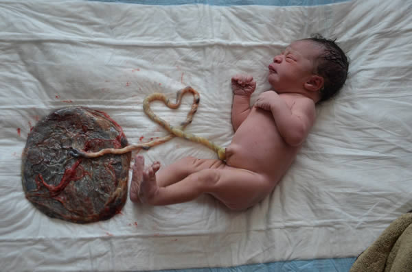 anticipazioni-infarto-addio-cervelli-cannibali-guerra-del-parto