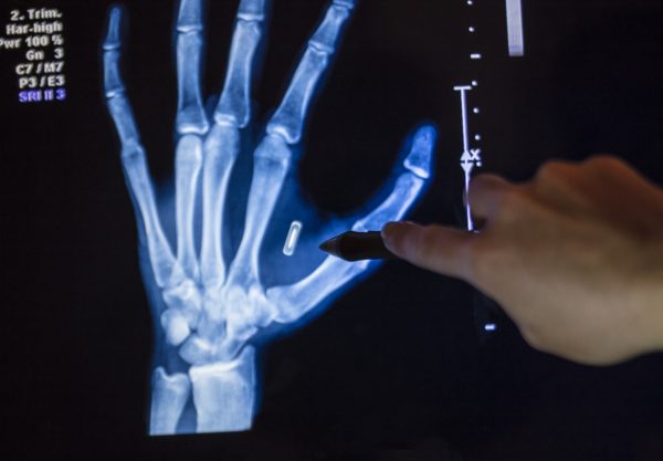 Uomini e microchip oltre i limiti della scienza