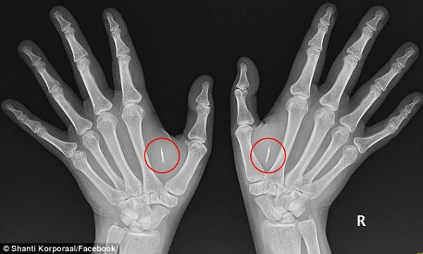 Uomini e microchip oltre i limiti della scienza