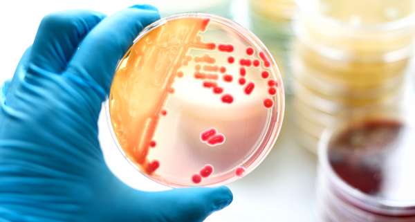 Batteri mortali le infezioni che minacciano il mondo