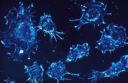 Cure antitumori dal genoma all’immunoterapia 