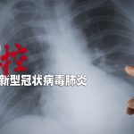 Cina nuovi virus mortali e misteri letali