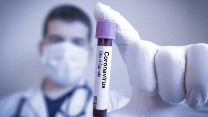 Cure anticoronavirus a che punto è la ricerca del vaccino