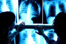 Chirurgia la rivoluzione della radiologia interventistica